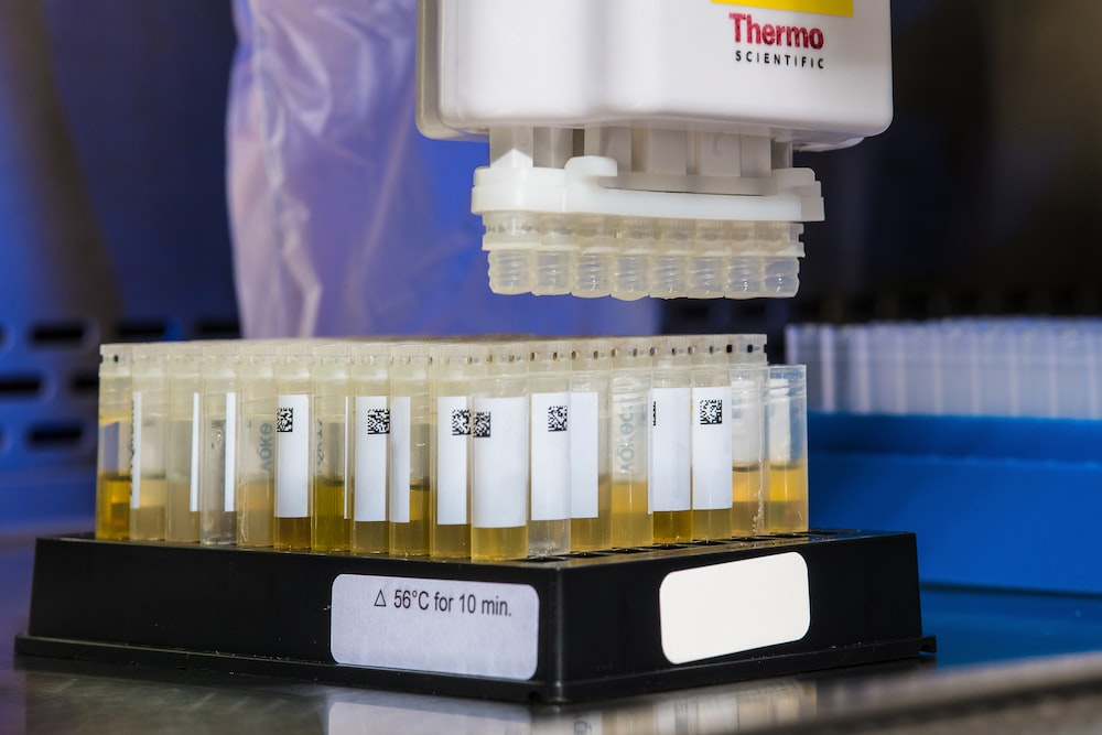 urine samples in a test tube