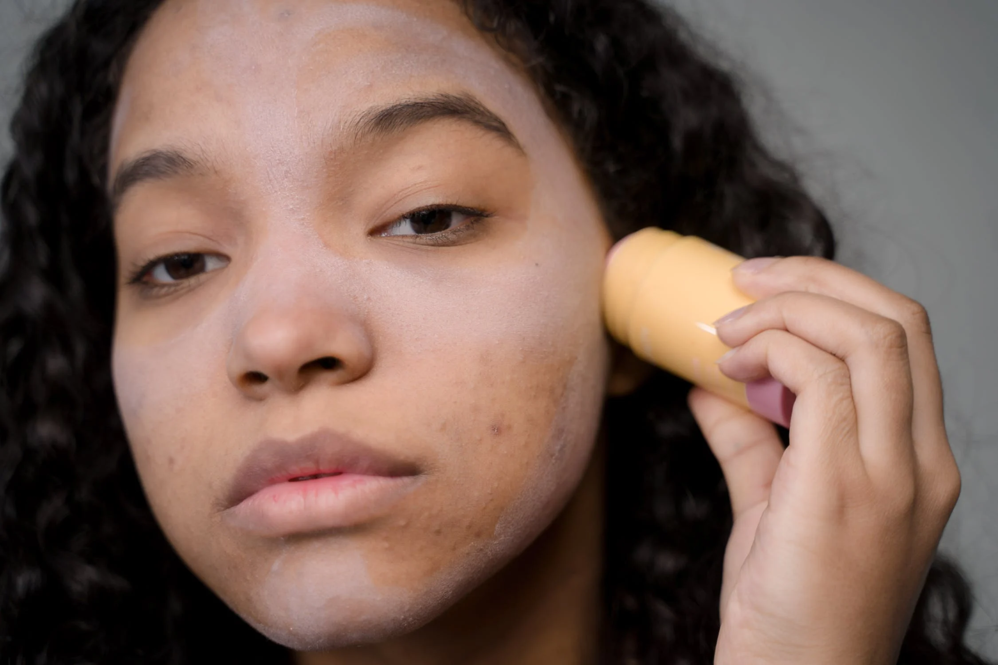 A woman covering her acne with makeup