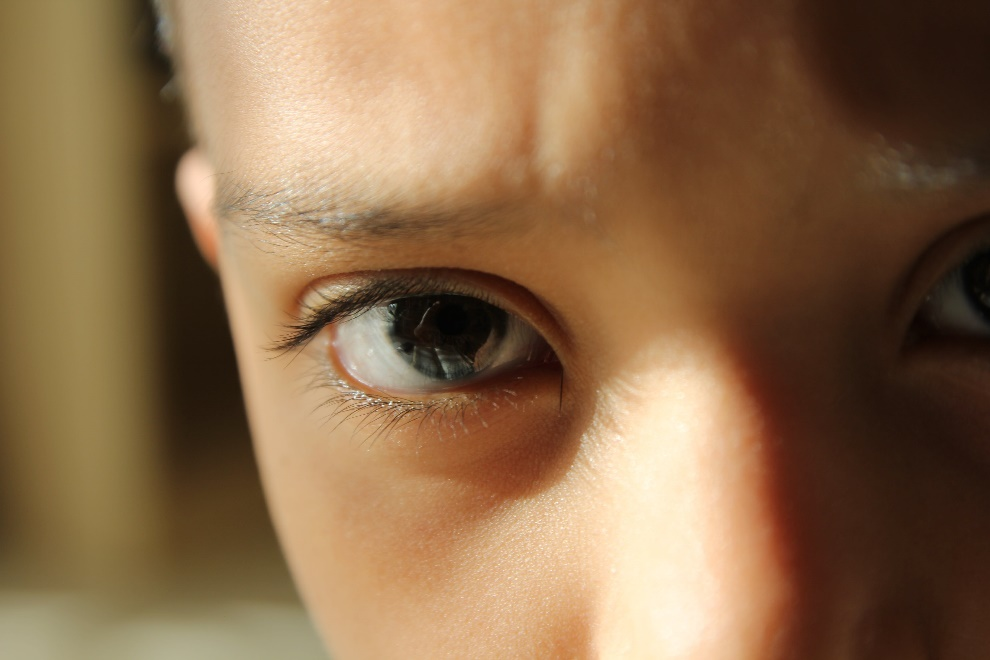 Sunlight hitting a child's eye