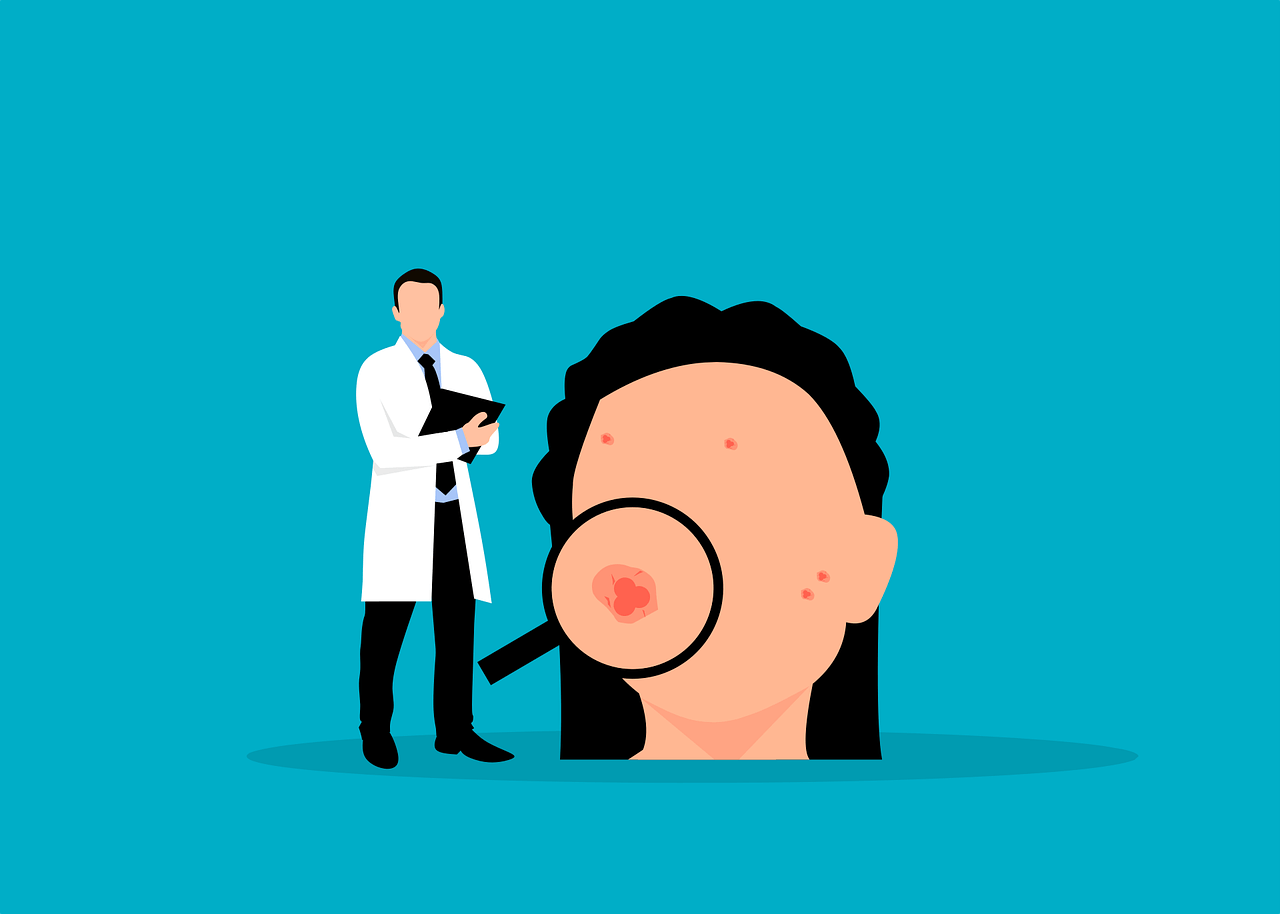 A dermatologist illustration of acne 