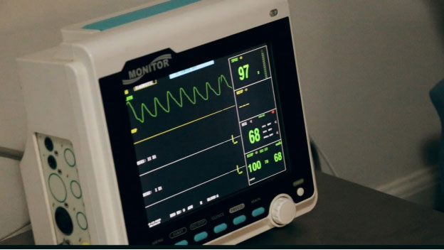 an ECG machine showing heart rate