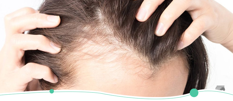 Online Doctor For Hair Loss | Symptoms And Causes Of Hair Loss | Virtual  Doctor For Hair Loss - TelMDCare
