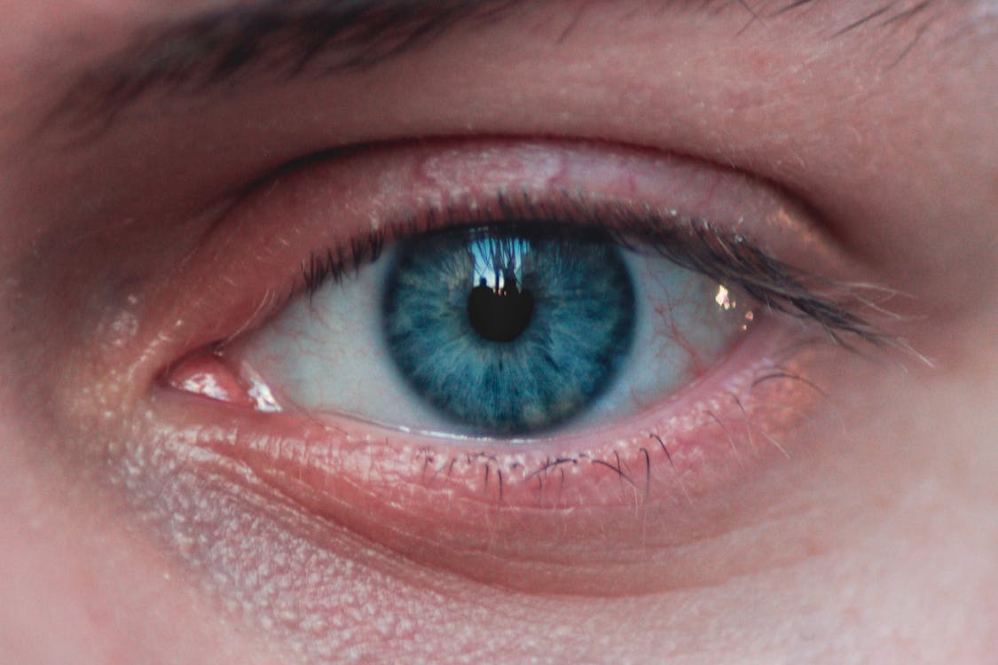 A closeup of an eye with a potential pink eye infection
