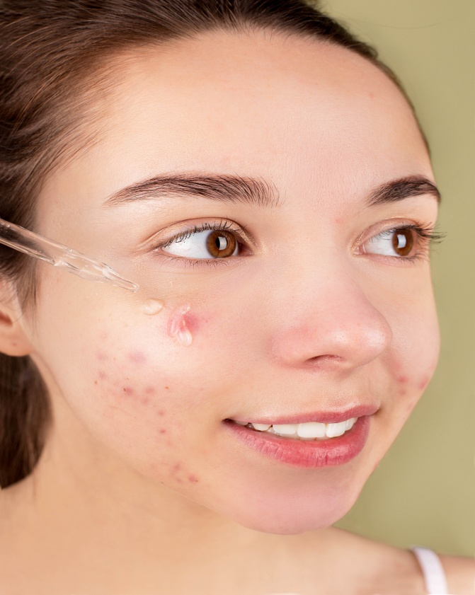 Woman doing skincare to prevent acne.