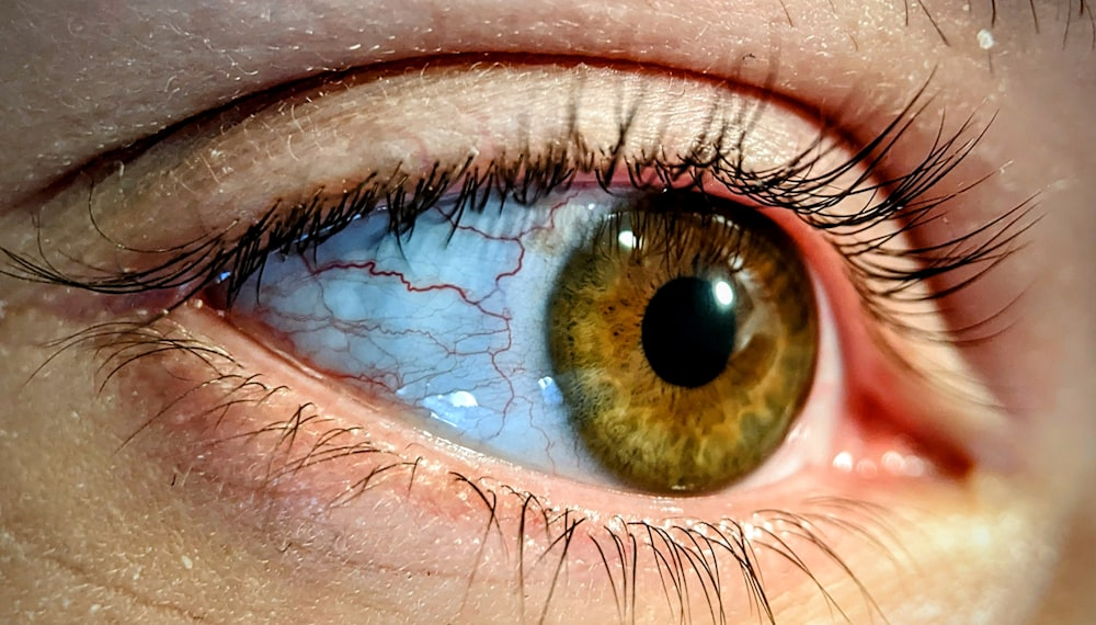 A closeup of a person’s brown eye with veins