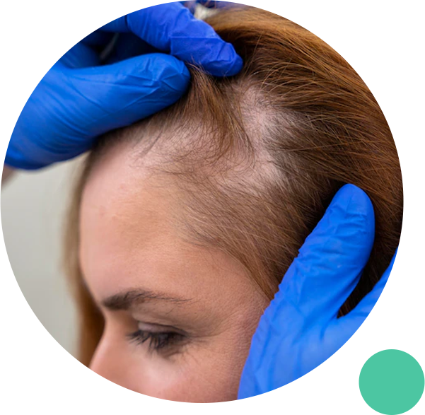 Online Doctor For Hair Loss | Symptoms And Causes Of Hair Loss | Virtual  Doctor For Hair Loss - TelMDCare