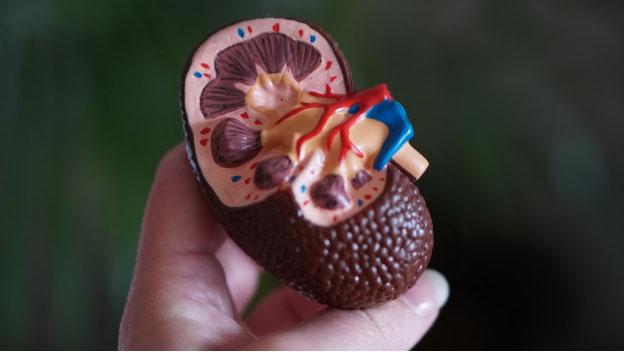 a cross-section of a kidney