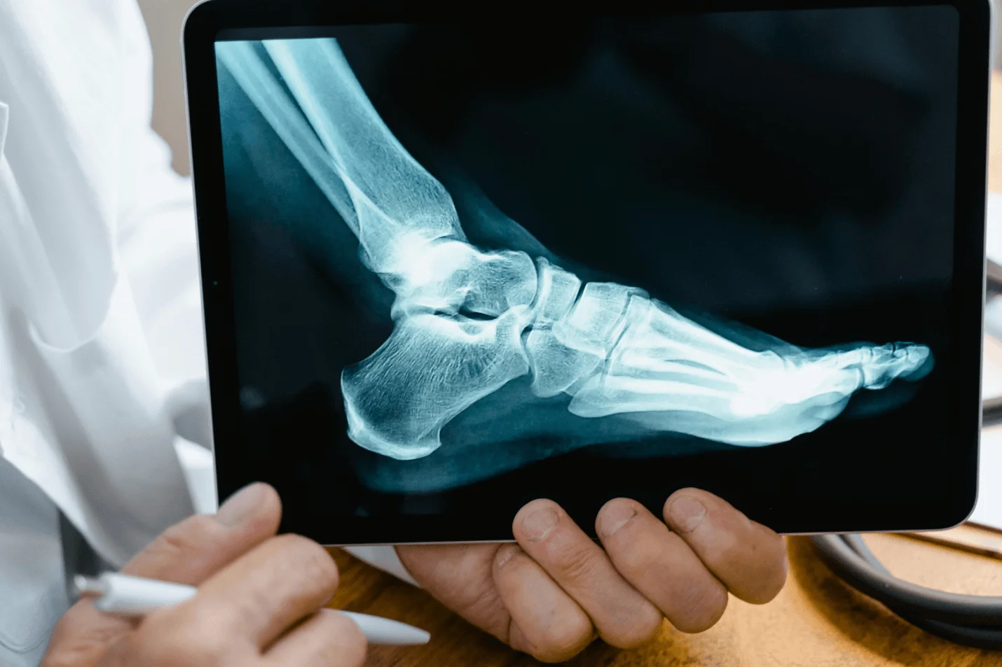 An x-ray of a foot on a digital tablet