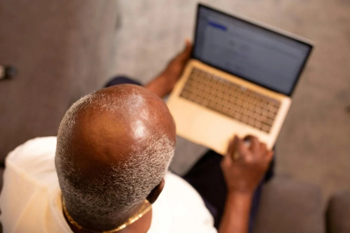 A bald man using a laptop to consult about hair loss solutions.