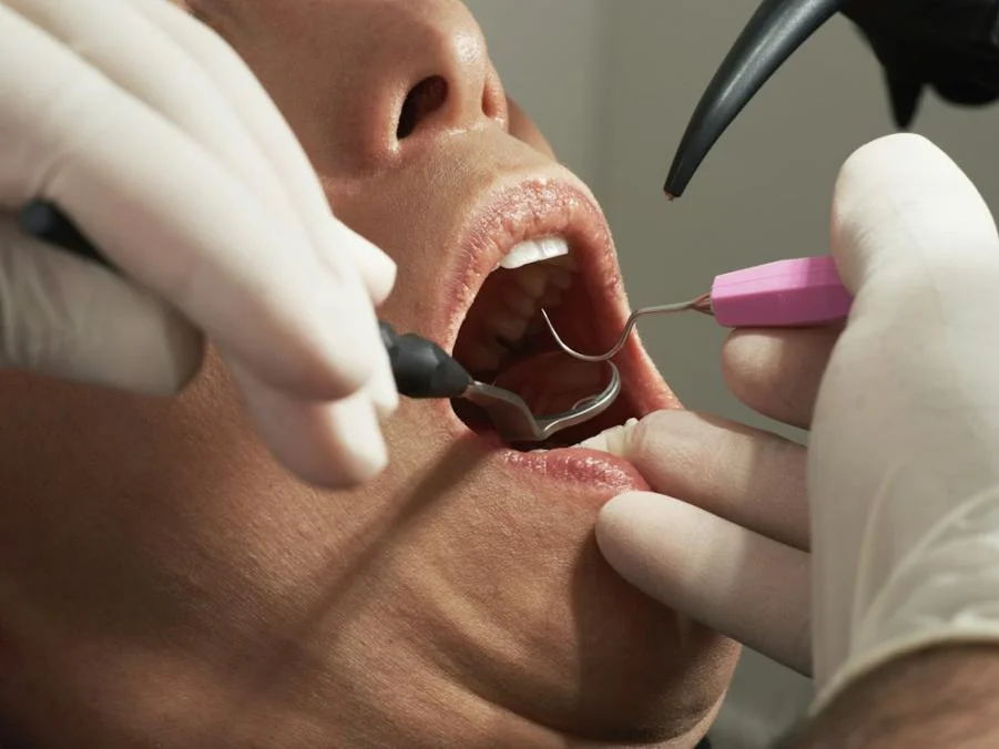 A woman getting a dental treatment