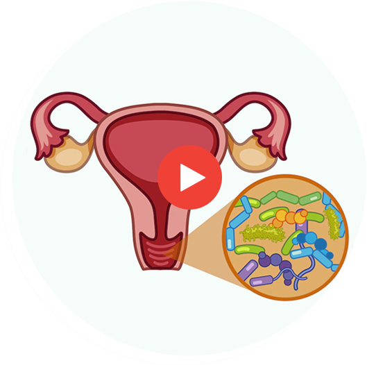 Yeast Infection While Breastfeeding? - Physician Guide to