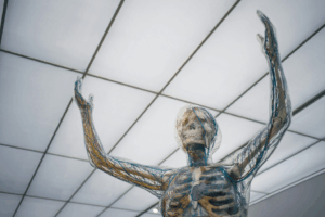 Living with Multiple Sclerosis: Symptoms and Support