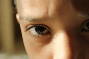 Prevention Tips for Cataracts
