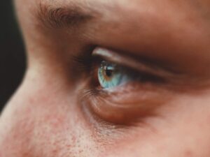 Eye Cancer Awareness: Safeguarding Your Vision