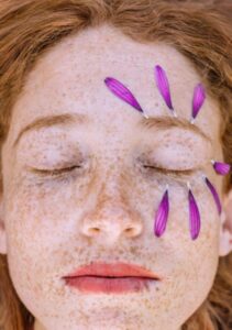 Skincare Decoded: A Holistic Approach to Acne Prevention and Treatment