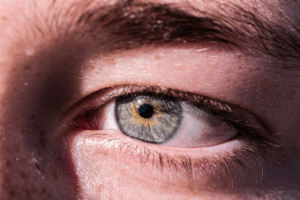 Pink Eye 101: 3 FAQs Answered For You By Experts