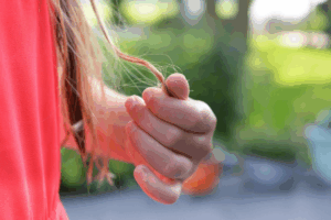 Experiencing Hair Loss? Here’s What You Need to Know