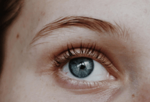 Treating Pink Eye