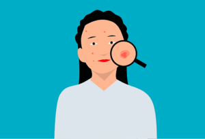 The Symptoms and Remedies for the Most Common Skin Diseases