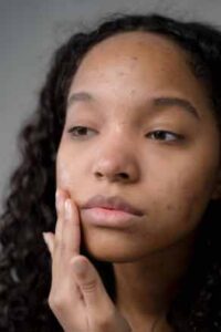 Skin Care: 3 Tips To Ensure A Healthy Skin