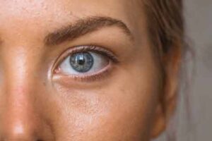 Stye: Causes, Symptoms, and Treatment