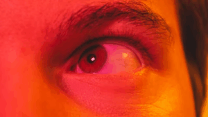 Virtual Doctor for Pink Eye: Fast Care Without the Clinic Visit