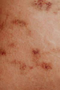 Virtual Doctor for Skin Rash: Clear Skin Before the New Year