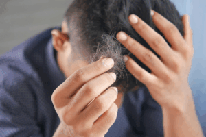 Sudden Hair Shedding: When Symptoms Point to Alopecia or Hormonal Issues