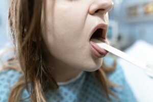 Oral Thrush Symptoms: The White Patches People Ignore