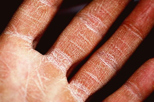close-up of a person's dry skin