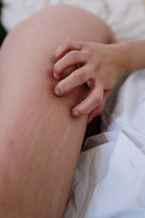 A person scratching their skin. 