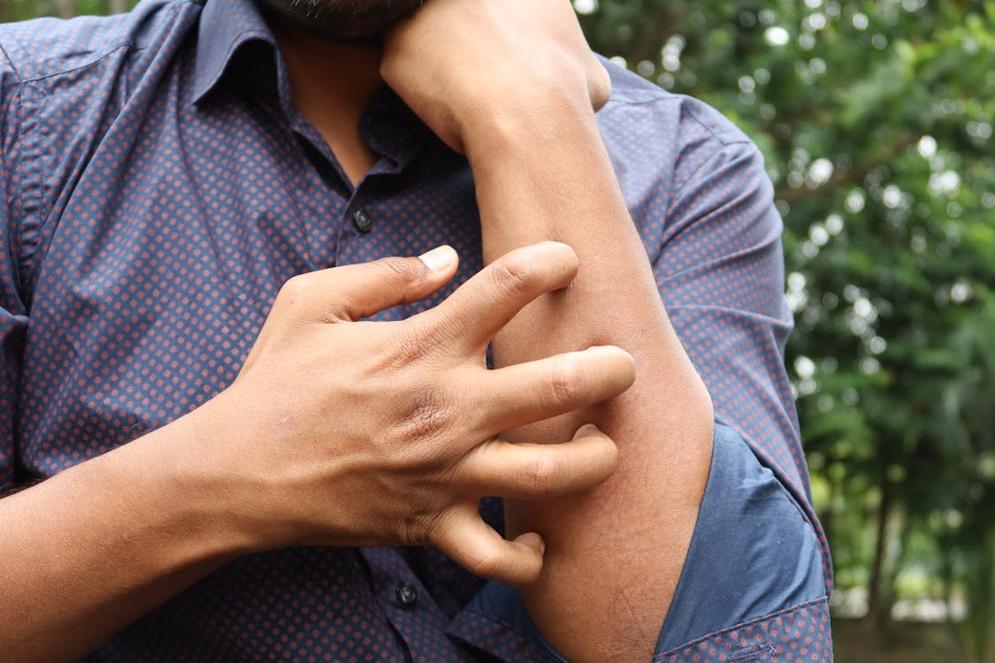 A person itching their skin.