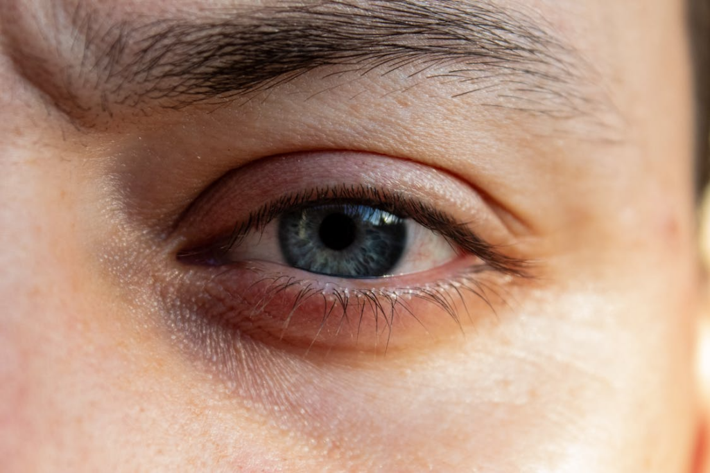 A person with irritated red eyes. 