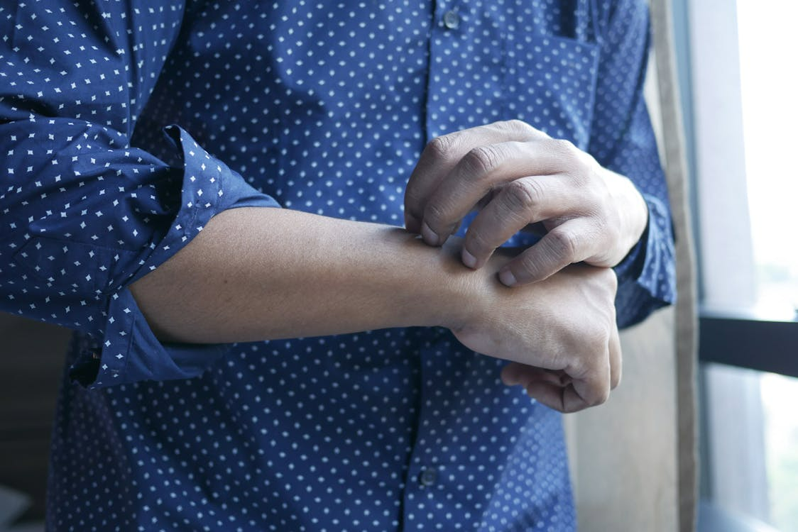 Person scratching irritated skin with possible scabies symptoms
